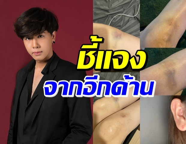 นัท โซลติส แจงอีกด้าน! หลังถูกอ้างทำร้ายแฟน-น้องหมา 4 ตัว