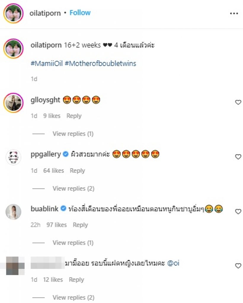 ออย ภรรยาบีม อวดท้องโต 4 เดือน แต่แฟนคลับหลุดโฟกัสทักเรื่องนี้?