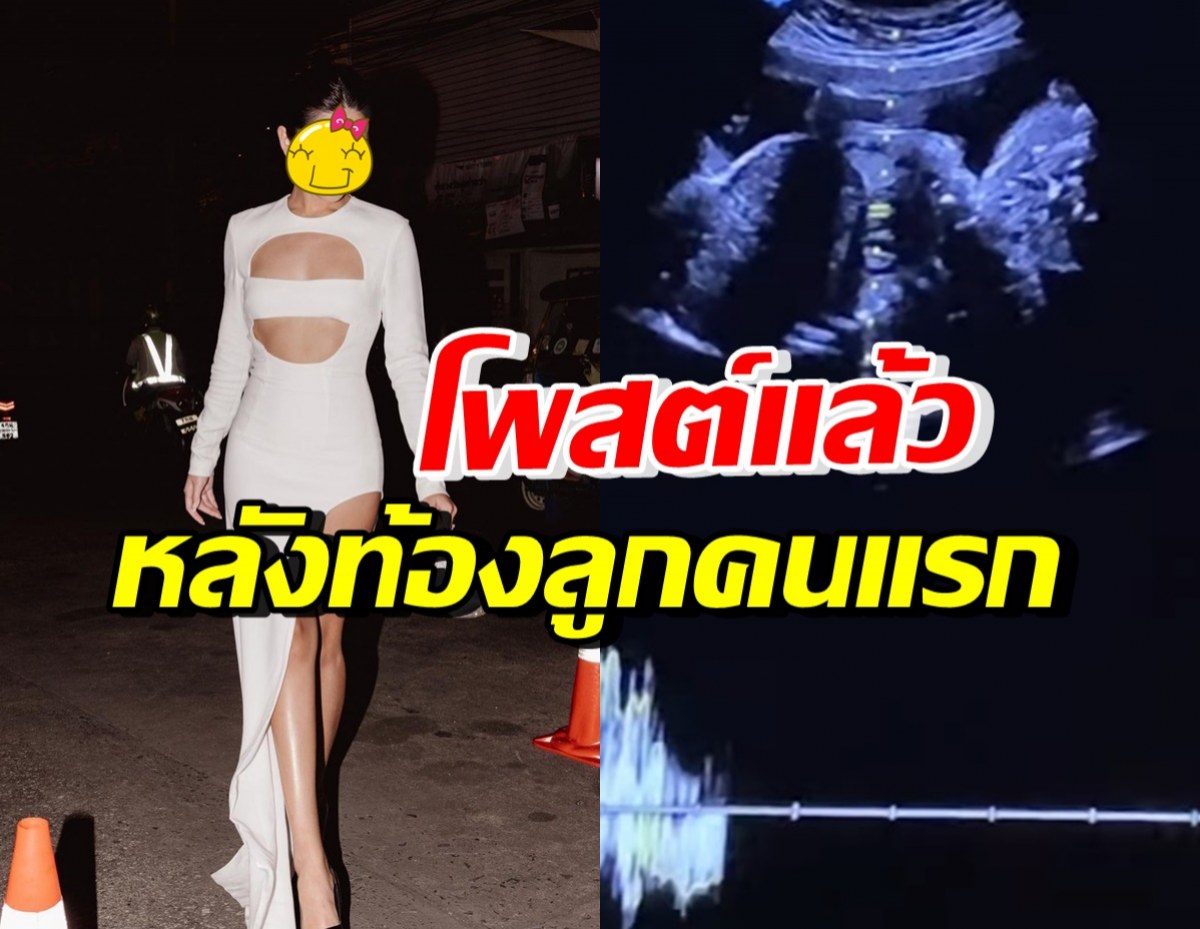 ดาราสาวดัง โพสต์แล้ว! หลังต้นสังกัดประกาศข่าวดี ตั้งท้องลูกคนแรก