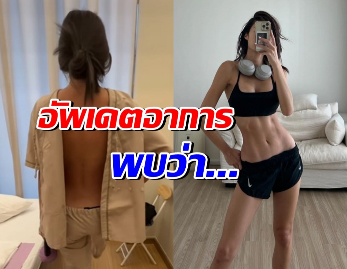 ยิปซี อัพเดตอาการหลังรักษาโรคนี้มา 1 ปีกว่า ล่าสุดพบว่า...?