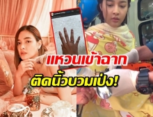 ‘ปุ๊กลุก’ งานเข้า! แหวนเข้าฉากติดนิ้วข้ามวัน นิ้วบวมเป่ง