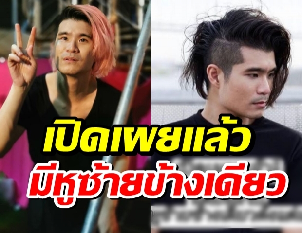 นต Getsunova ยอมคายความลับ เกิดมาก็มีหูซ้ายข้างเดียว!