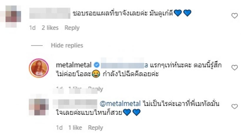 เปิดรอยแผลเป็นที่ต้นขา เมทัล ที่ตอนแรกมั่นใจ แต่ตอนนี้ไม่โอ