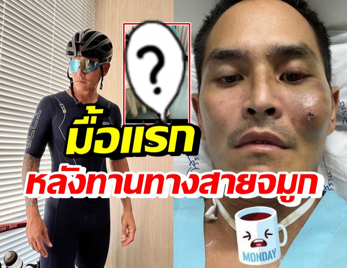 สงกรานต์ดีใจ หลังทานอาหารทางสายจมูก7วัน วันนี้ได้ทานสิ่งนี้แล้ว!?