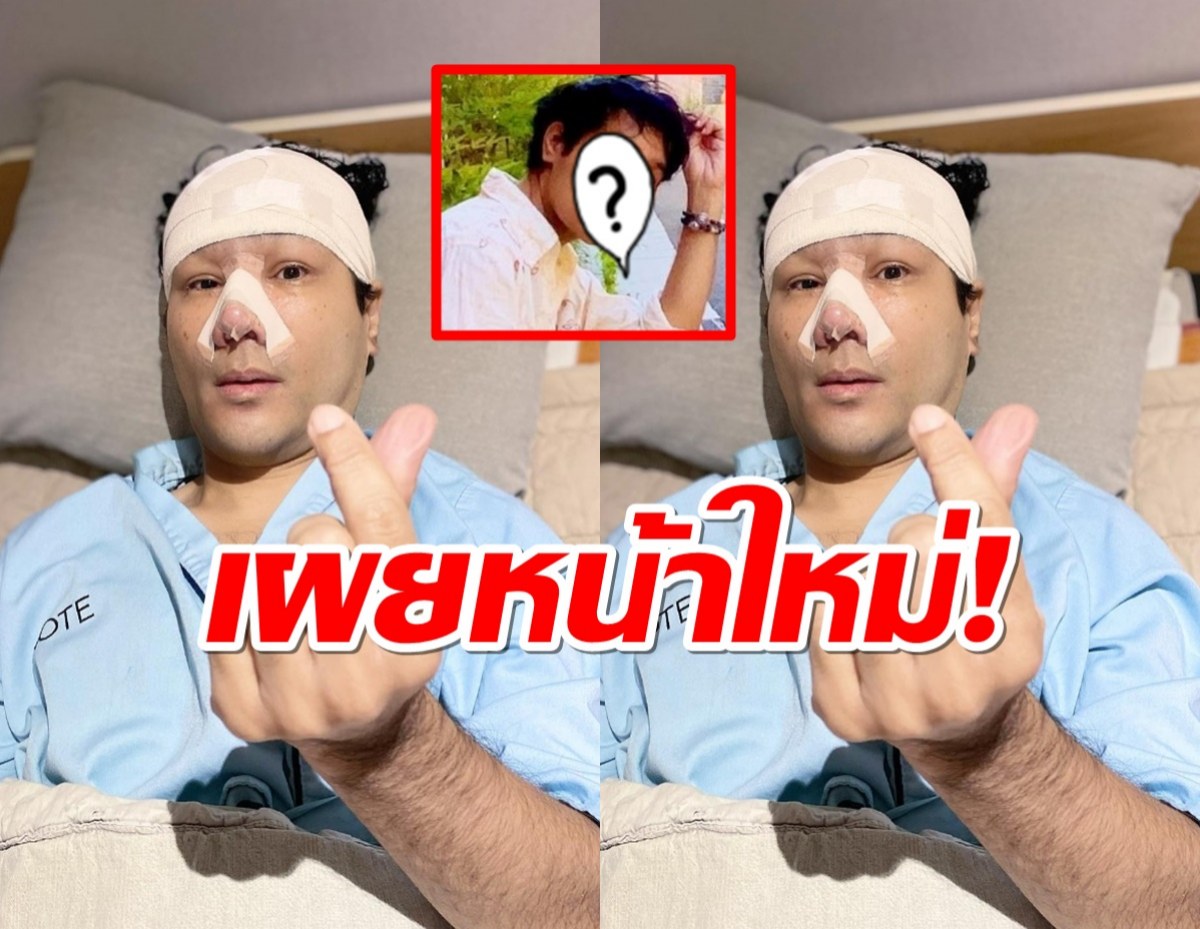 มาแล้ว!หน้าใหม่เอี่ยมของกอล์ฟ เบญจพล หลังบินด่วนทำศัลยฯรอบสอง