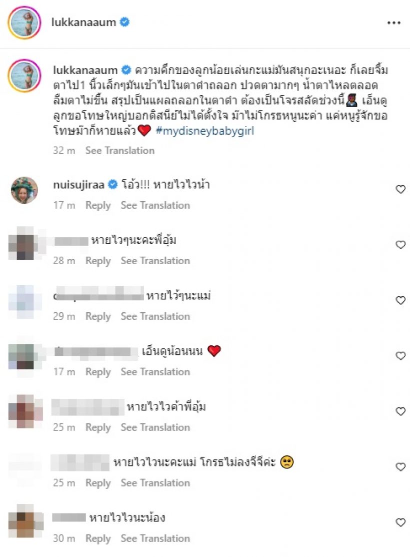 อุ้ม ลักขณา เผยสาเหตุแผลถลอกในตาดำ เอ็นดูลูกสาวรีบขอโทษ