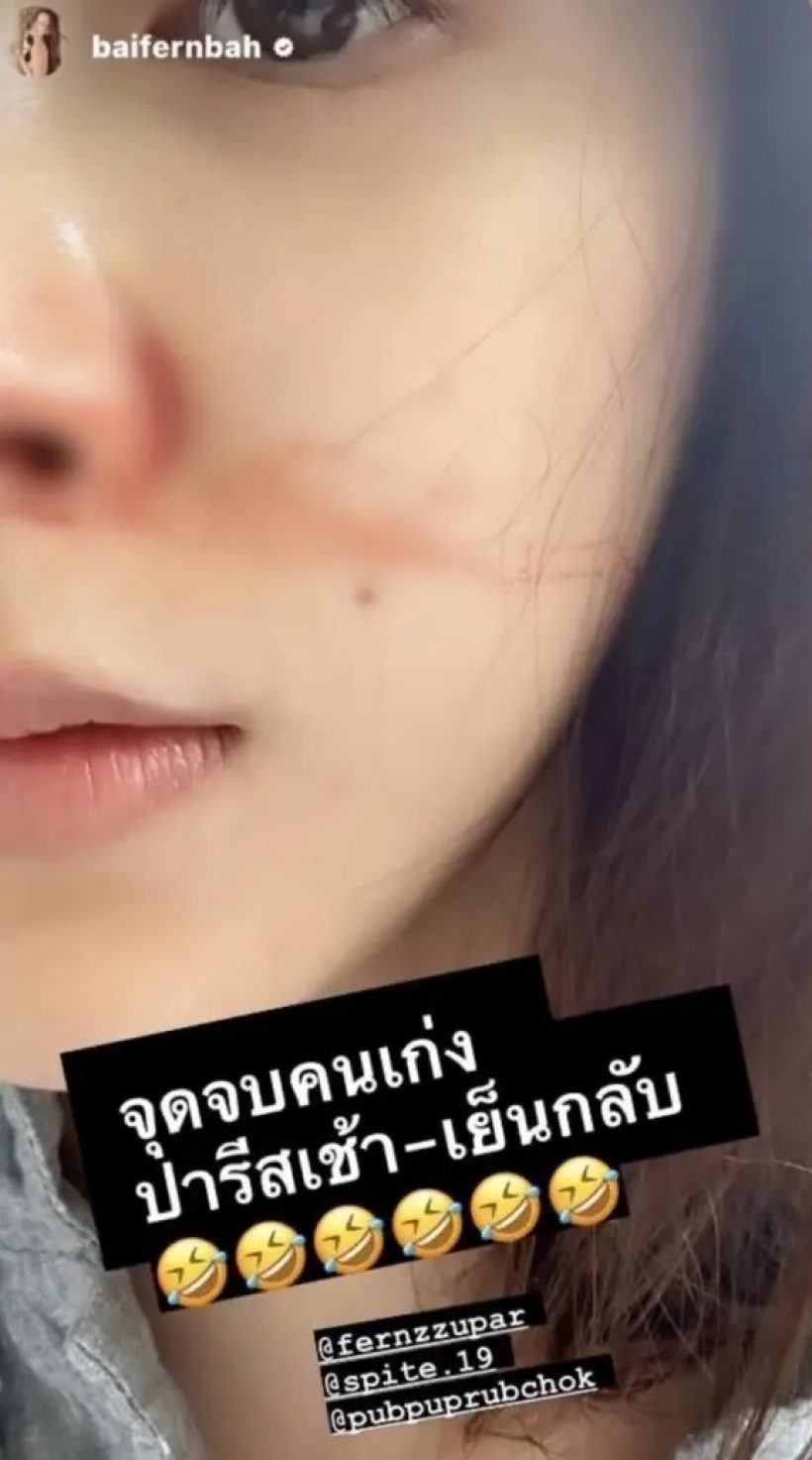 จุดจบคนเก่ง ใบเฟิร์น พิมพ์ชนก มีอาการแบบนี้? หลังโหมงานหนัก