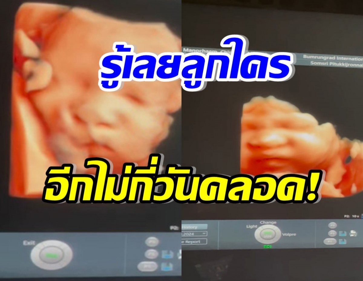 นับถอยหลังไม่กี่วัน นางเอกดังคลอดลูกคนแรก หน้าเหมือนพ่อ