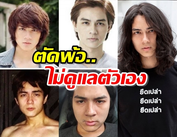 แน็ก ชาลี โพสต์รูป ตัดพ้อใบหน้าตัวเอง เผย อุทหรณ์ไม่ดูแลตัวเอง!