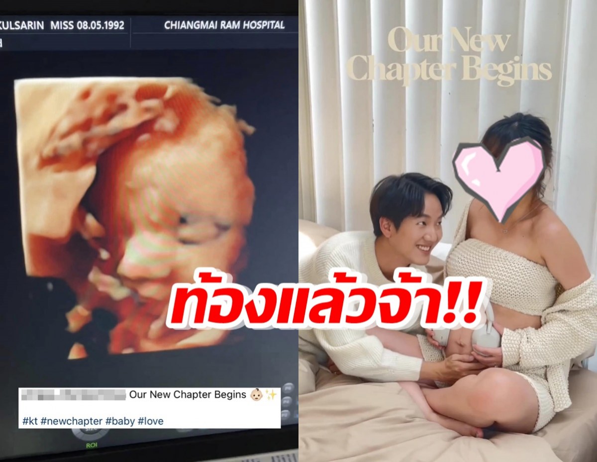 ขอแสดงความยินดี ดาราสาวประกาศข่าวดี ท้องลูกคนแรก 