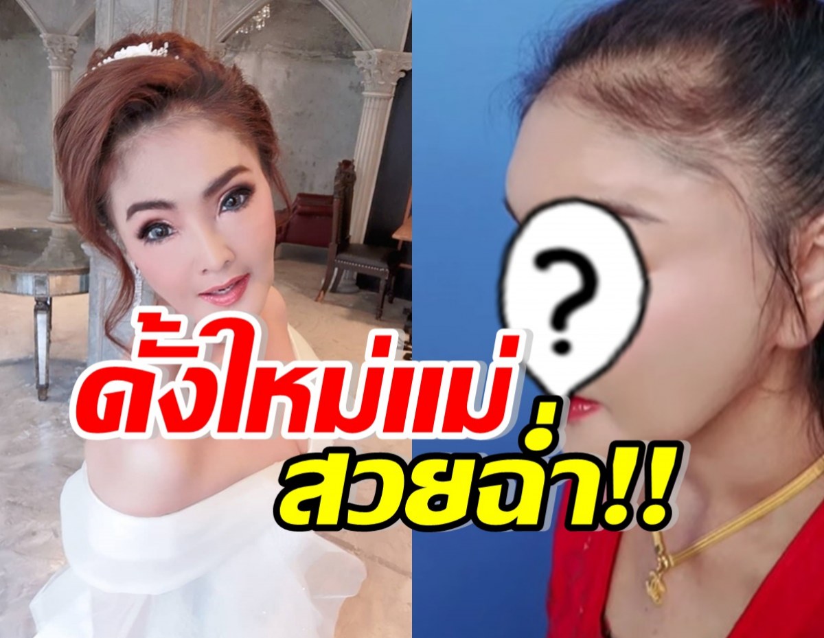 มีอึ้ง! เปิดหน้าล่าสุด ดาว มยุรี หลังทำจมูกมาใหม่ในรอบ 20 ปี