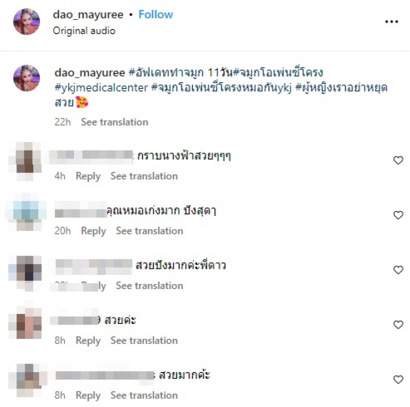 มีอึ้ง! เปิดหน้าล่าสุด ดาว มยุรี หลังทำจมูกมาใหม่ในรอบ 20 ปี