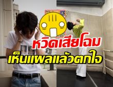 หวิดเสียโฉม! เปิดแผลบนหน้า ดาราหนุ่มฮอต ทุกคนเห็นแล้วตกใจ