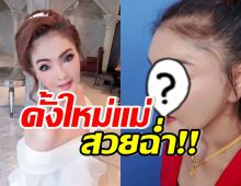 มีอึ้ง! เปิดหน้าล่าสุด ดาว มยุรี หลังทำจมูกมาใหม่ในรอบ 20 ปี