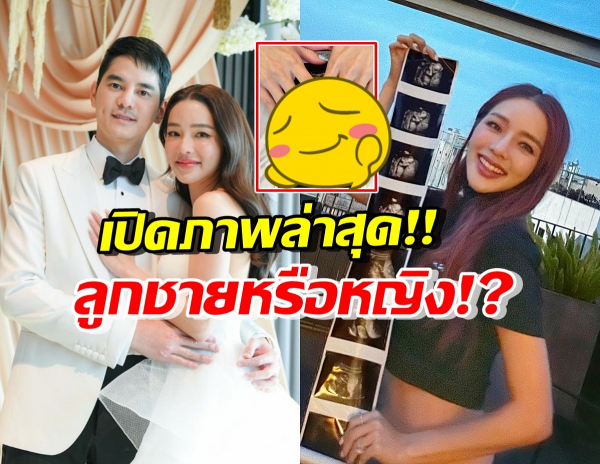 แอร์ ภัณฑิลา เปิดภาพอัลตร้าซาวด์ลูกคนแรก ชวนทายชายหรือหญิง?