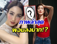 ‘แต้ว ณฐพร’ ลุคแมงมุมขยุ้มหัวใจ แต่โดนทักผอมเหมือนป่วย! 