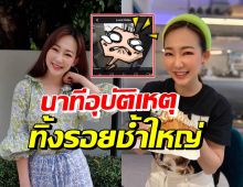 หญิง กัญญา เปิดคลิปอุบัติเหตุหน้าบ้าน เจ็บมาก-แทบลุกไม่ไหว