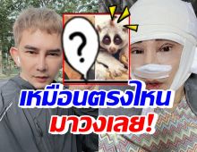 พชร์ อานนท์ เปิดหน้าใหม่ดูเด็กลงมาก แต่ถูกทักเหมือนแรคคูน