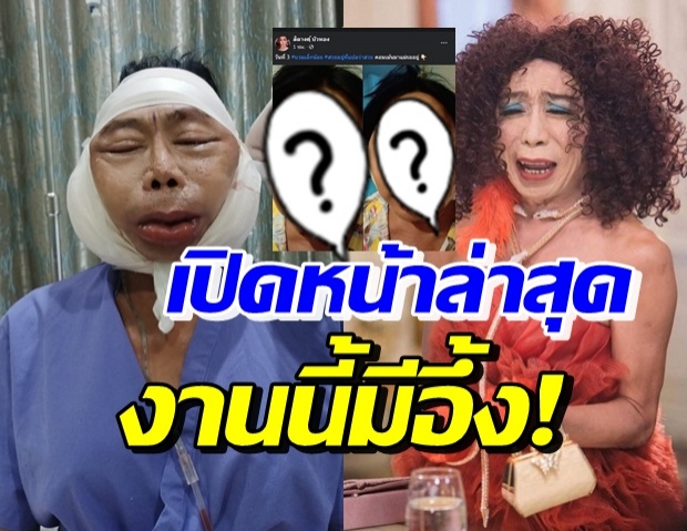 มาแล้ว! แม่สิตางศุ์ เปิดหน้าโชว์หลังผ่าตัด ชัดๆ ทำอะไรบ้าง?