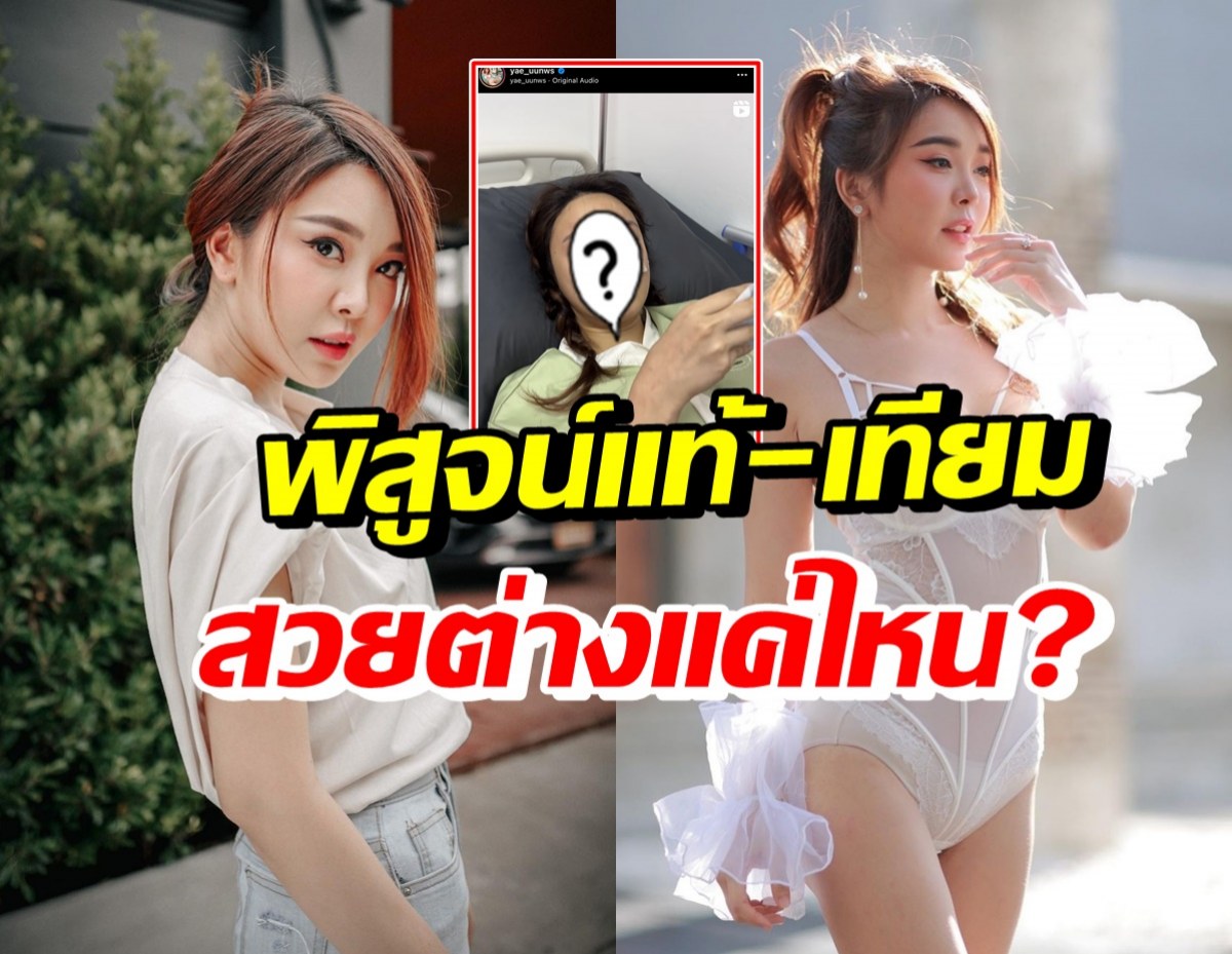 ยลโฉมล่าสุด หญิงแย้ งัดซิลิโคนจมูกออกแล้ว-เพราะเหตุนี้?