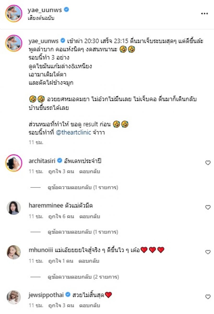 เปิดหน้าล่าสุด ดาราสาวเจ้าแม่ศัลยกรรม ไปทำอะไรบ้าง ดูเลย!