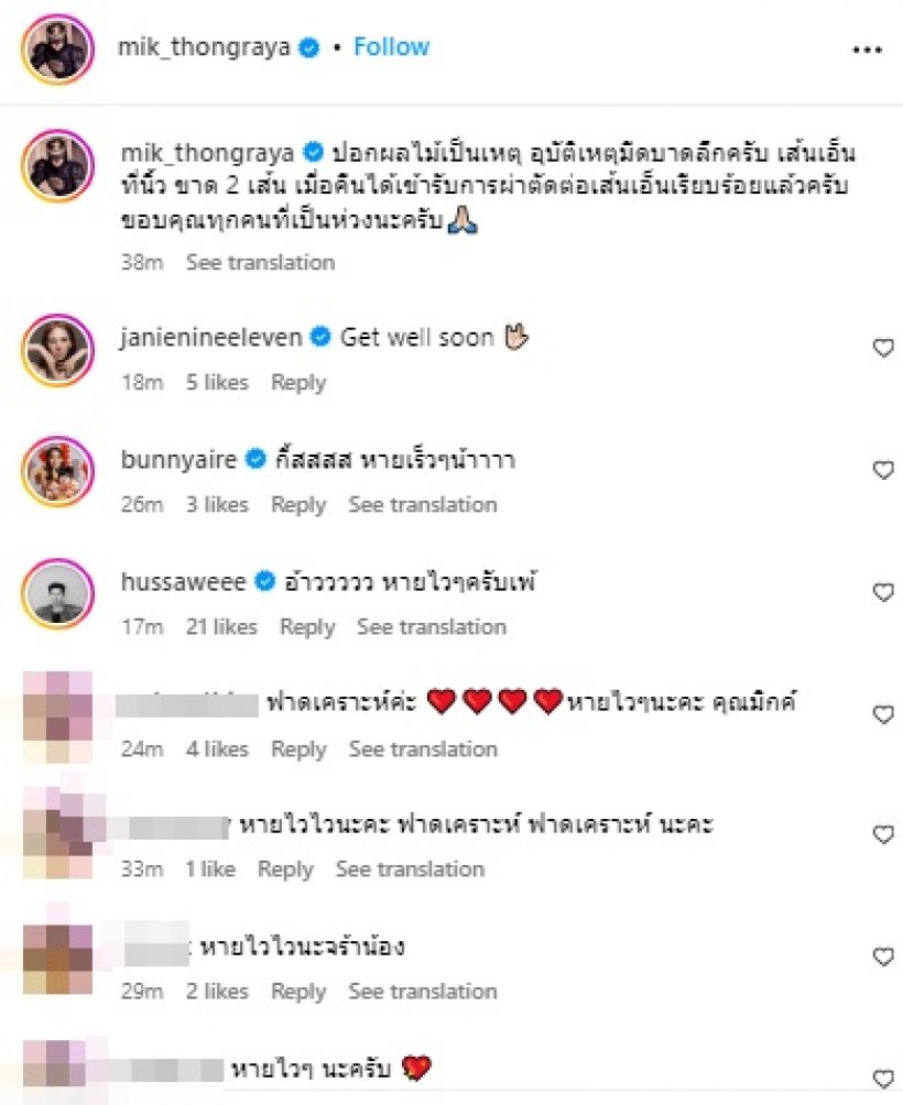 เห็นแล้วช็อก! มิกค์ ทองระย้า เกิดอุบัติเหตุ โพสต์เผยอาการล่าสุด