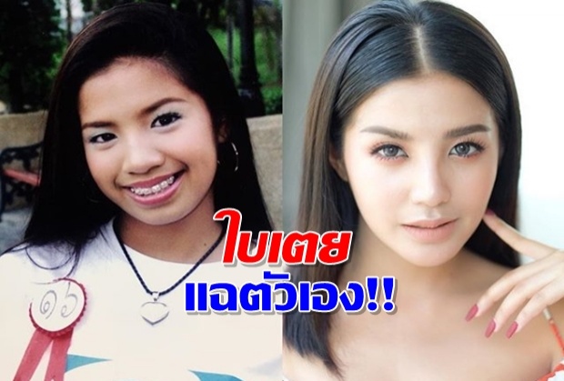  แฉตัวเองได้ใจพอ-‘ใบเตย’ โพสต์รีวิวหน้าในอดีตก่อนจะมาไกลในวันนี้!