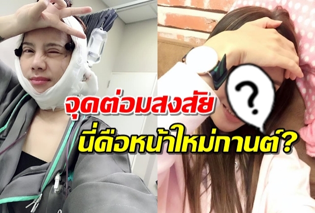 หน้าใหม่รึเปล่า? กานต์โพสต์รูปจุดต่อมสงสัย หลังอัพหน้ามัดใจเสก