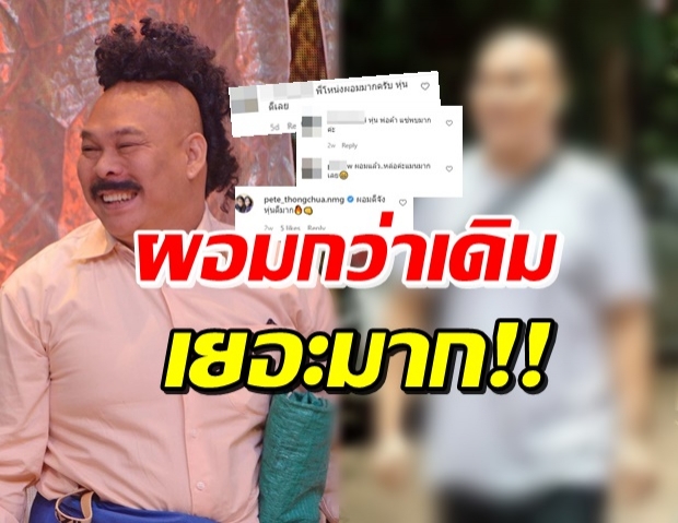  เปิดหุ่นล่าสุด “โหน่ง” ผอมลงมากจน “พีท ทองเจือ” ยังต้องทัก!