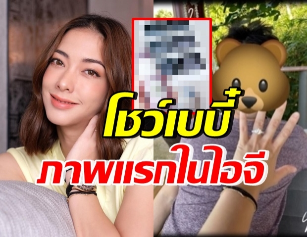   มาแล้ว! “แป้ง อรจิรา” โชว์ภาพเบบี๋ในท้อง หลังประกาศข่าวดี 