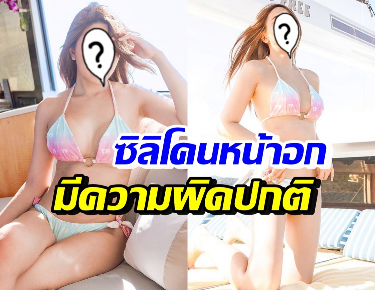 ดาราสาวเจ้าแม่ศัลยกรรม พบเนื้องอก-ความผิดปกติของซิลิโคนหน้าอก