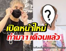 พชร์ อานนท์ ยอมเปิดหน้าให้เห็นชัดๆหลังศัลยกรรม 1 เดือน พร้อมฝากถึงคนบูลลี่