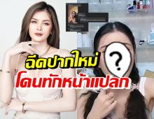 ปากใหม่ทำหน้าแปลก? เอ๋ มิรา โดนทักแรง หลังอัพความสวยล่าสุด