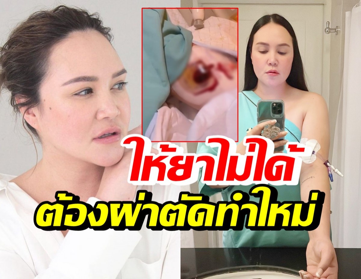 เกิดอะไรขึ้น!? ทาทา ยัง เผยต้องผ่าตัดใหม่ ขณะรักษาตัวป่วยโควิด