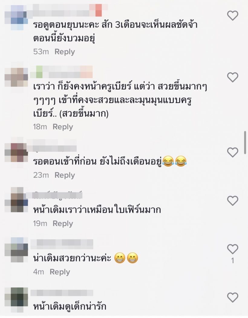 สาวสุดฮอต ทุบหน้าใหม่ทำสวยที่เกาหลี แต่ชาวเน็ตบอกหน้าเดิมดูดีกว่า!!