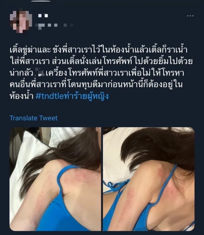 โผล่อีกราย! นักร้องหนุ่มฮอต โดนแฉรัวๆทำร้ายผู้หญิงปางตาย 