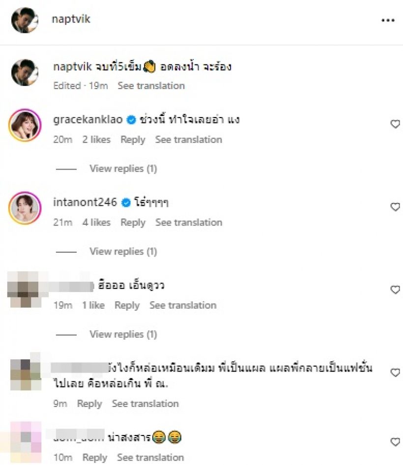  เปิดหน้าล่าสุดดาราหนุ่มดัง ประสบอุบัติเหตุ เย็บ5เข็ม