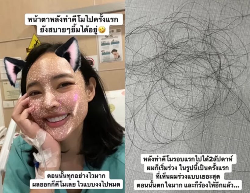 จำได้มั้ย? ออน พัชรวรรณ ทรมานป่วยโรคร้าย-รักษามาครึ่งทางแล้ว