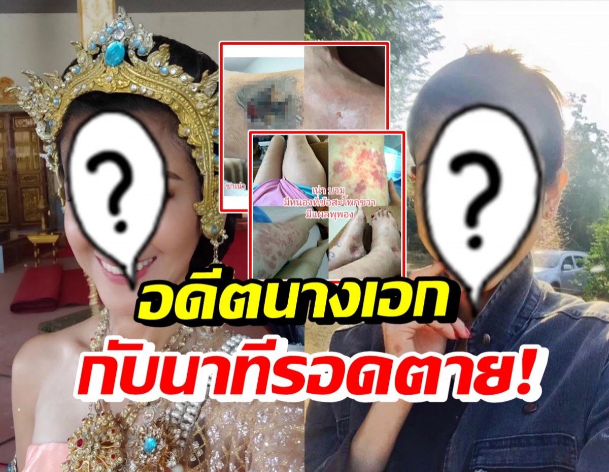 ช็อก! อดีตนางเอกดัง เผยเหตุการณ์รอดตาย หัวใจ-ไตวายเฉียบพลัน