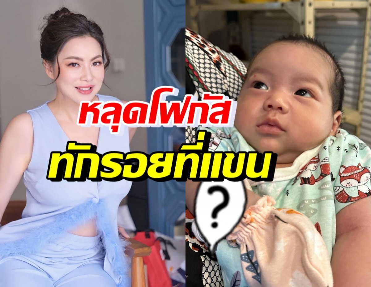 บุ๋ม ปนัดดา เผยความน่ารักน้องอเล็กซ์ แต่หลุดโฟกัสทักรอยที่แขนน้อง!