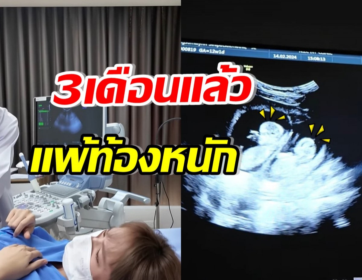 นางเอกดังเผยท้องลูกแฝด3เดือนแล้ว น้ำตาแทบร่วง แพ้ท้องหนัก