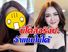 อึ้ง! หน้าใหม่ นิโคล หลังศัลยกรรมครบ1เดือน ในวัย51ปี