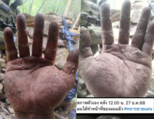 เห็นแล้วจุก! เผยสภาพมือทหารกล้า หลังเฝ้าชายแดนช่องอานม้า 20 วันรวด