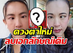 ภาพล่าสุดตลกดัง ตาหวาน ได้ดวงตาใหม่ แทบจำหน้าเดิมไม่ได้