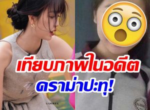 ซุปตาร์สาว งานเข้า! โดนอดีตเพื่อนสนิทเเฉประเด็นศัลยกรรม