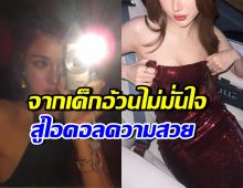 ดาราสาวดัง ยอมรับศัลยกรรมเพราะมีปม ตอนเด็กอ้วน-ไม่สวย