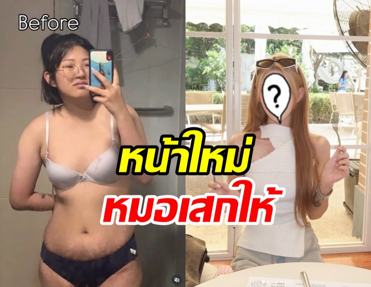 ทายาทนางเอกดังตอบไม่กั๊ก! หน้านี้สวยจริงเพราะมีดหมอ