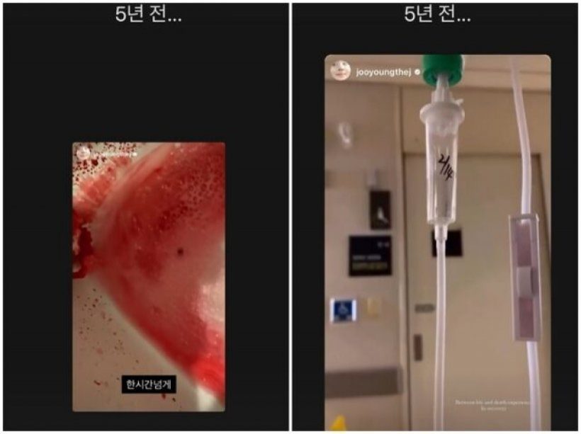 เเฟนๆใจหาย! นักเเสดงสาว เลือดกำเดาไหลรุนเเรงขั้นวิกฤต