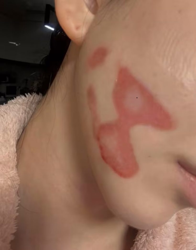 เเฟนๆส่งกำลังใจ ศิลปินสาว เตรียมลุยงาน หาเงินรักษาหน้า