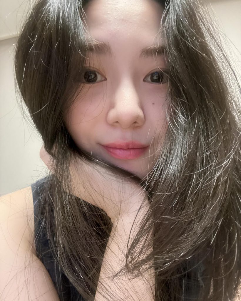 ดาราสาว เผยรอยแผลหน้าเสียโฉม ไม่ท้อสมัครงานหาเงินรักษา